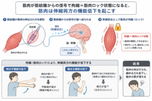 筋肉ロックは筋肉の能力を低下させる
