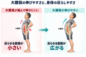 大腰筋が伸びると反りやすくなる