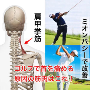 ゴルフの首痛の原因は肩甲挙筋の筋肉ロック