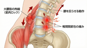 腰椎椎間関節の痛み