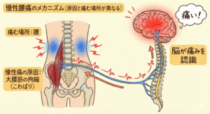 腰痛を感じる仕組み