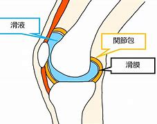 膝の関節包